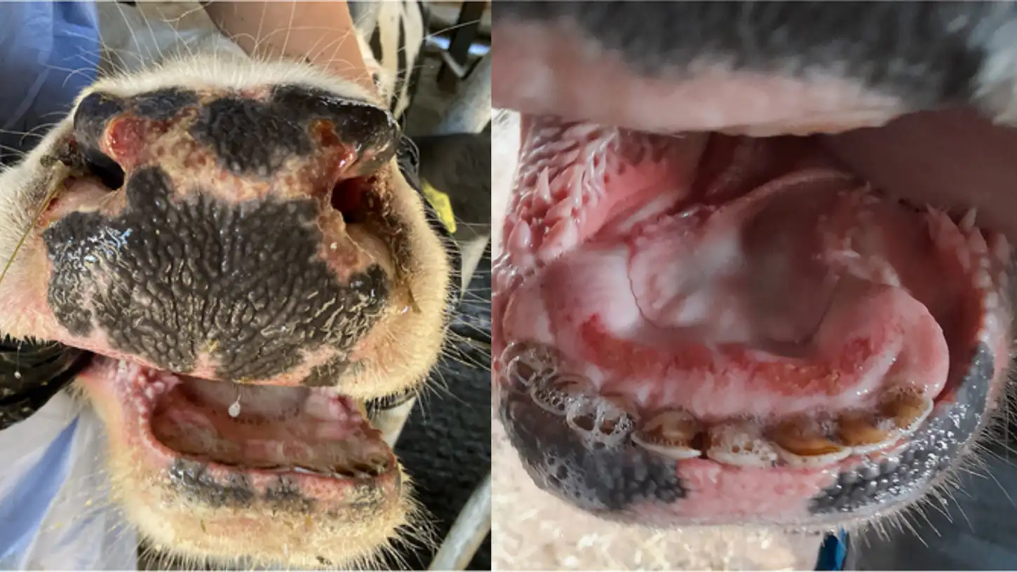 Mavi Dil Hastalığı Belirtileri